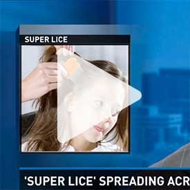 Lice CLinics of America on NBC Charlotte news